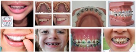 Tiêu chí đánh giá bác sĩ niềng răng tốt