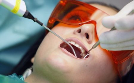 cách làm trắng răng tại nha khoa
