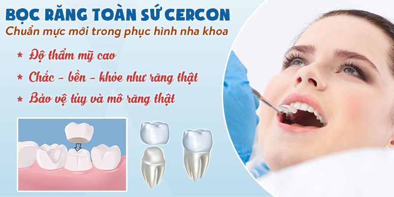 Bọc răng sứ toàn sứ cercon