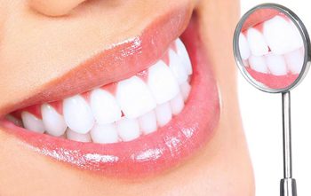 Bọc răng sứ có những ưu điểm gì?