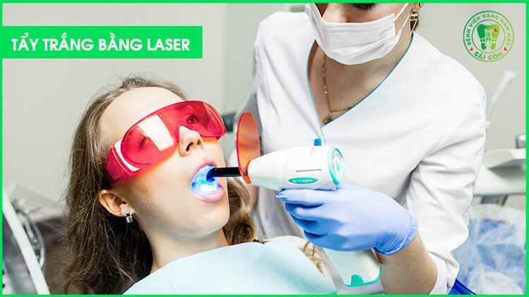 tẩy trắng răng bằng Laser