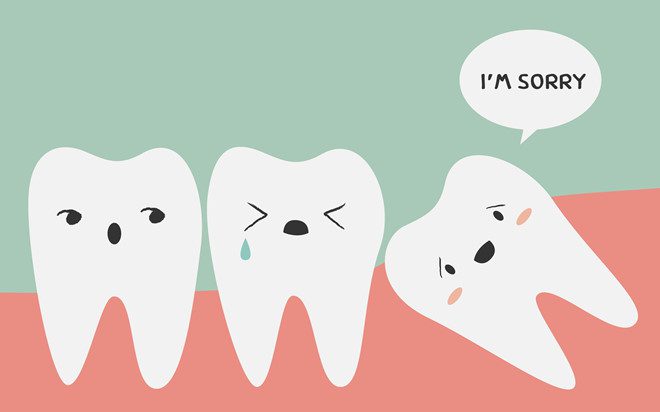 Răng khôn khi nào mọc?