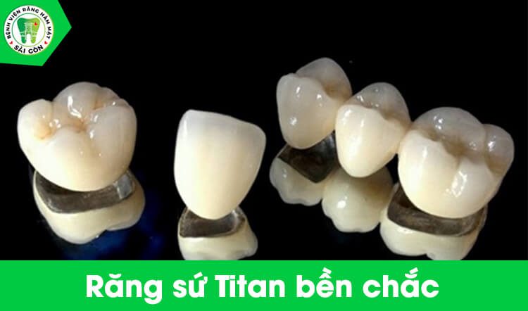 răng sứ Titan