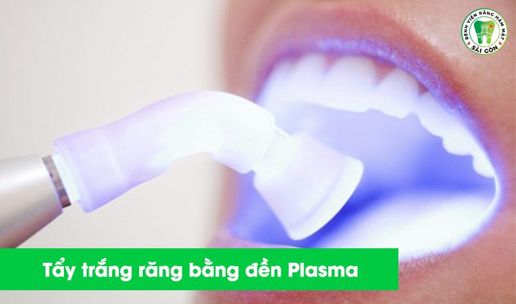 Tẩy trắng răng bằng đèn Plasma