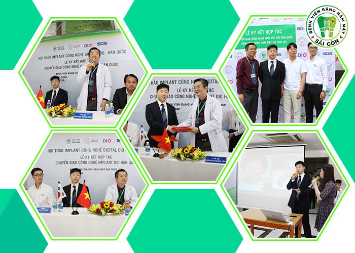 công nghệ Implant
