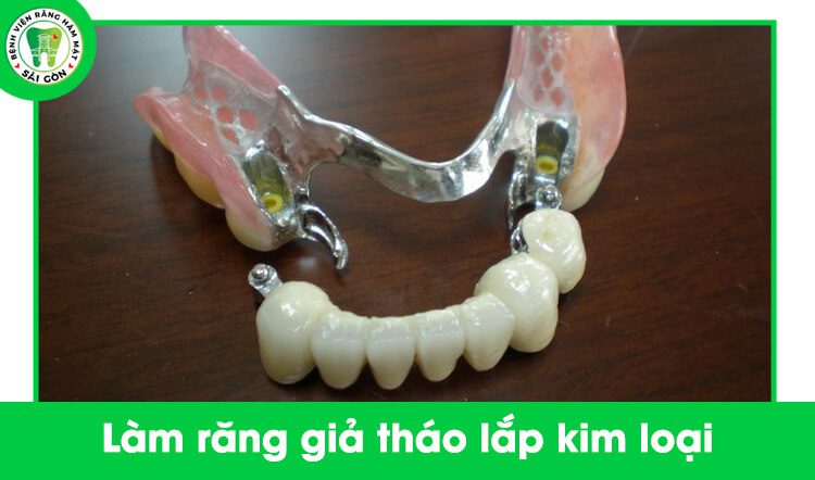 Trồng răng giả tháo lắp là gì? Giá bao nhiêu tiền? - Bệnh Viện Răng Hàm Mặt Sài Gòn